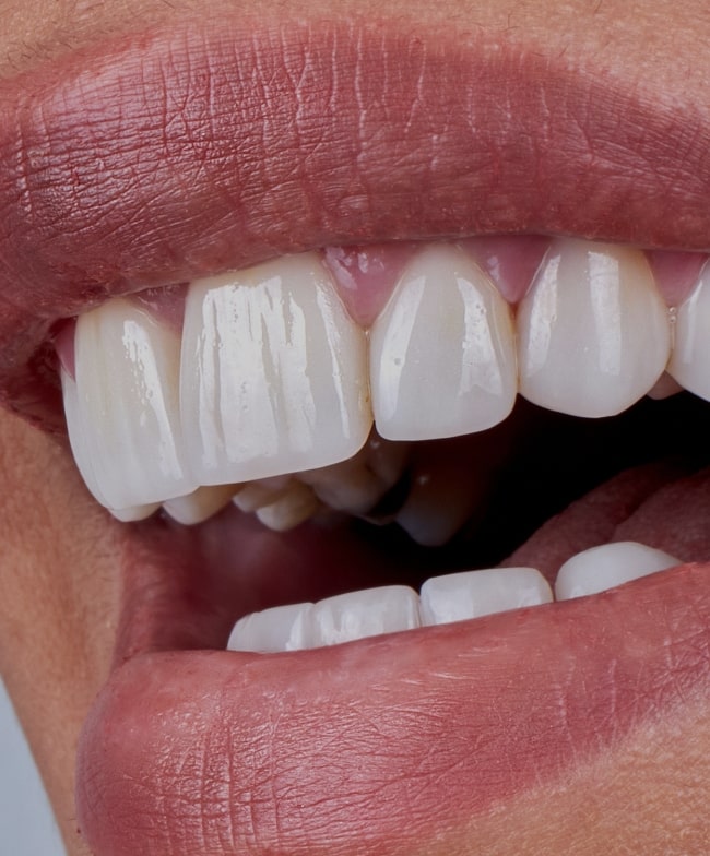 Treatment -  Smile & Beyond