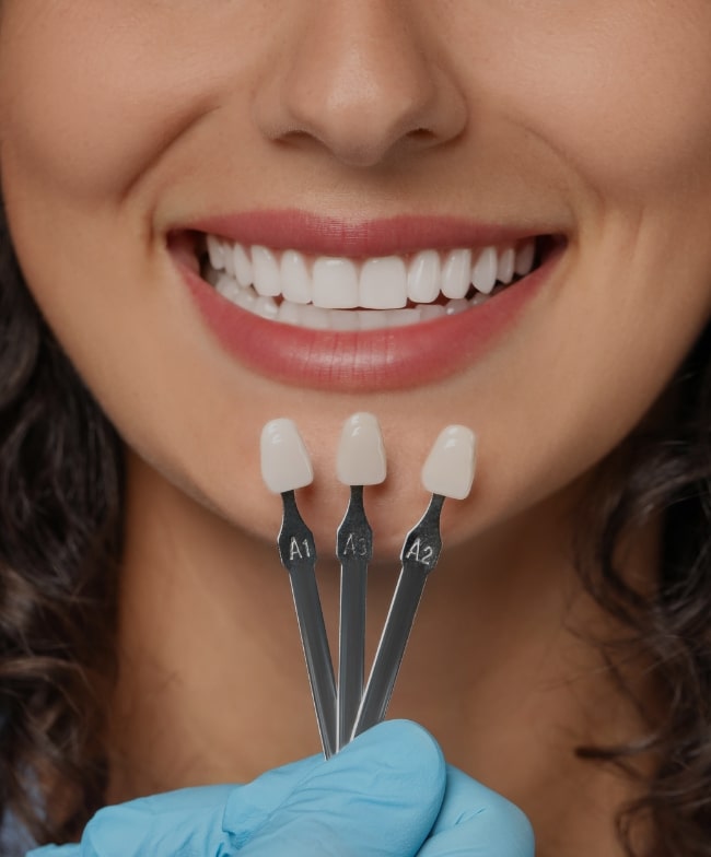 Treatment Category - Smile & Beyond