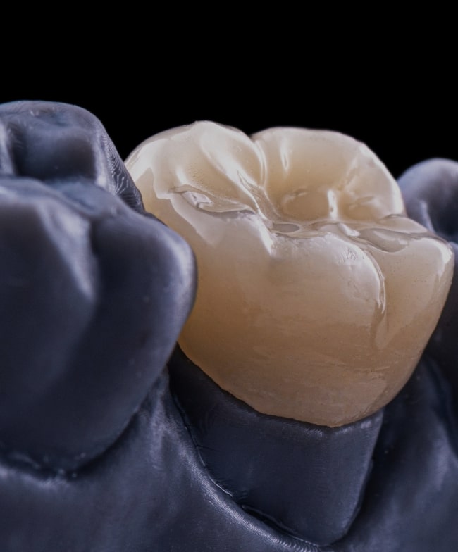 Treatment -  Smile & Beyond