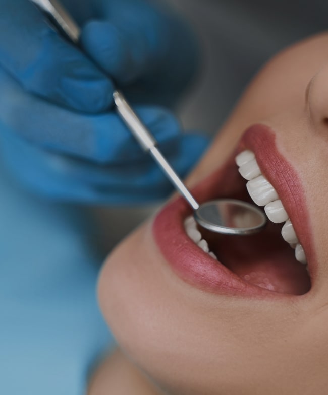 Treatment -  Smile & Beyond