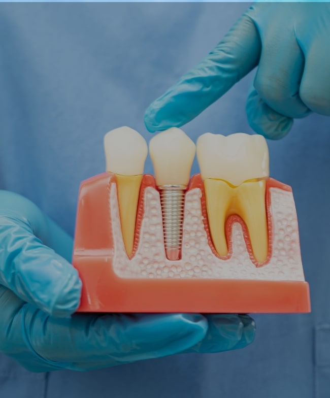 Treatment Category - Smile & Beyond