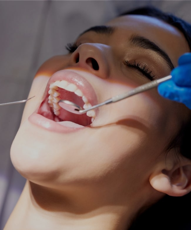 Treatment Category - Smile & Beyond