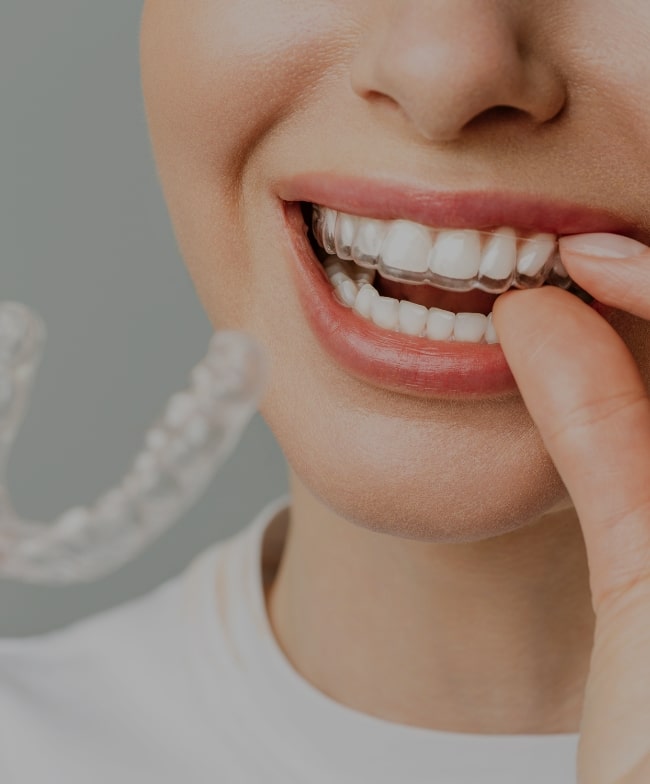 Treatment Category - Smile & Beyond