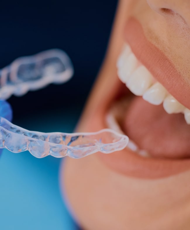 Treatment -  Smile & Beyond