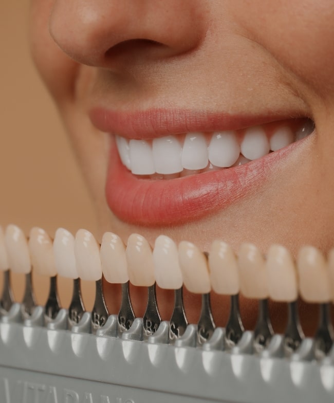 Treatment -  Smile & Beyond