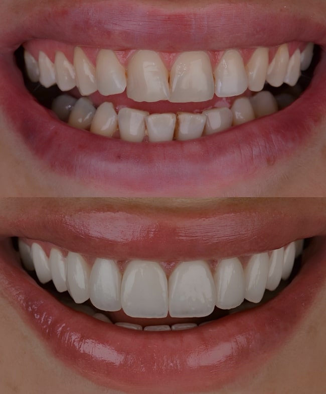 Treatment -  Smile & Beyond