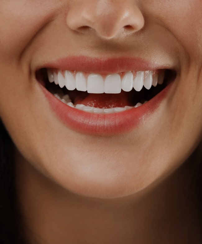 Treatment -  Smile & Beyond